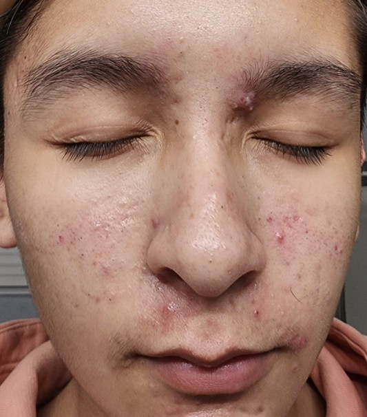 Desert Reset Facial