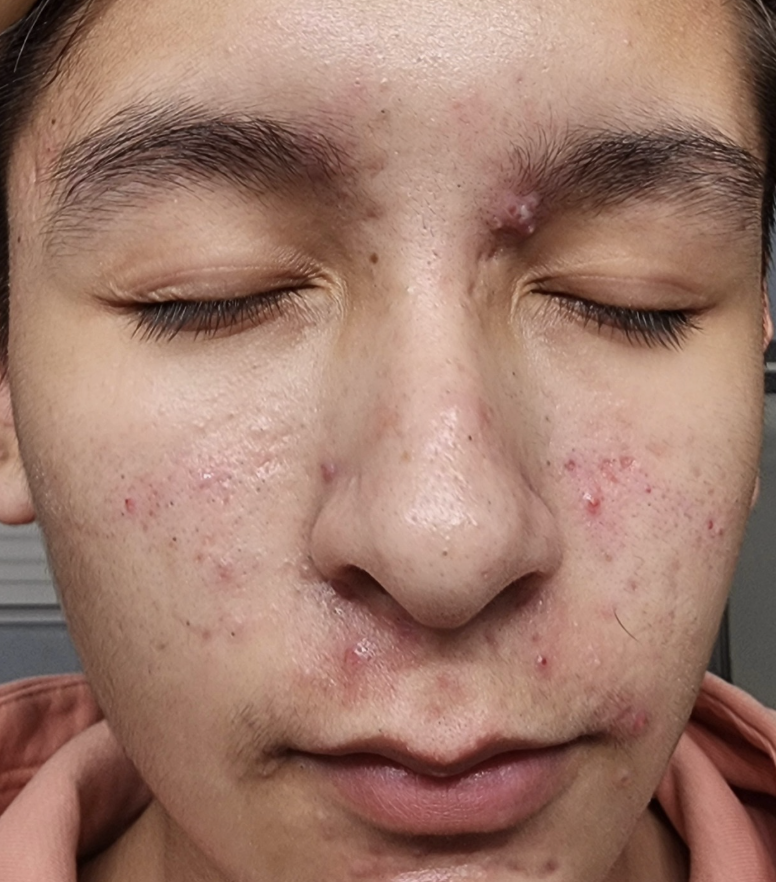 Desert Reset Facial